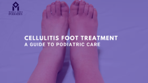 Read more about the article Cellulitis Foot Treatment: A Guide to Podiatric Care