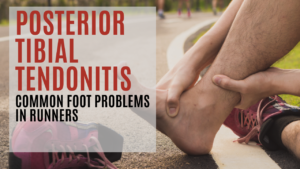 Read more about the article Posterior Tibial Tendonitis: Common Foot Problems in Runners