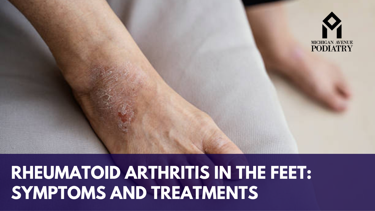 You are currently viewing Rheumatoid Arthritis in The Feet: Symptoms and Treatments