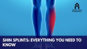 Read more about the article Shin Splints: Everything You Need to Know