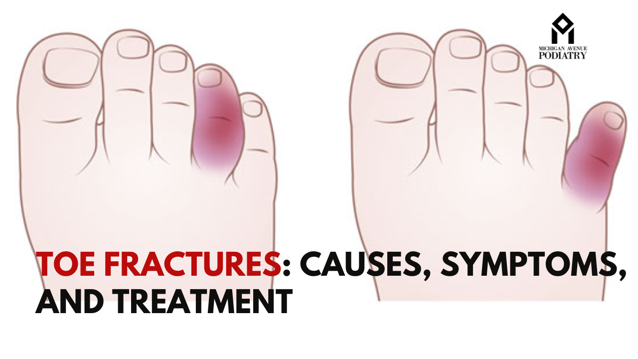 You are currently viewing Toe Fractures: Causes, Symptoms, and Treatment