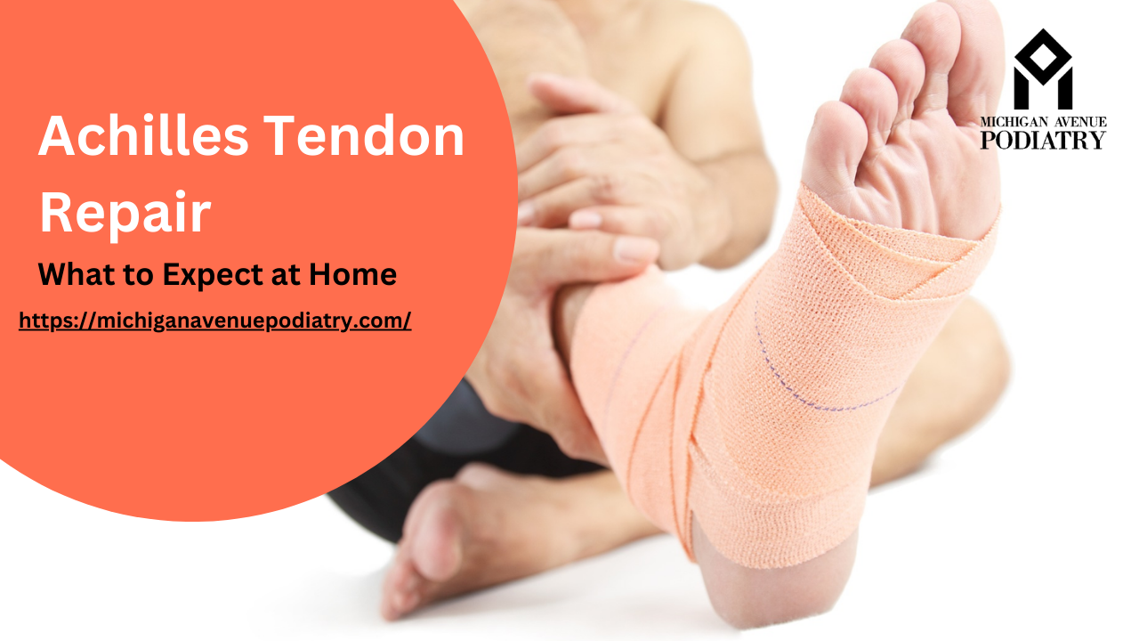 You are currently viewing Achilles Tendon Repair: What to Expect at Home
