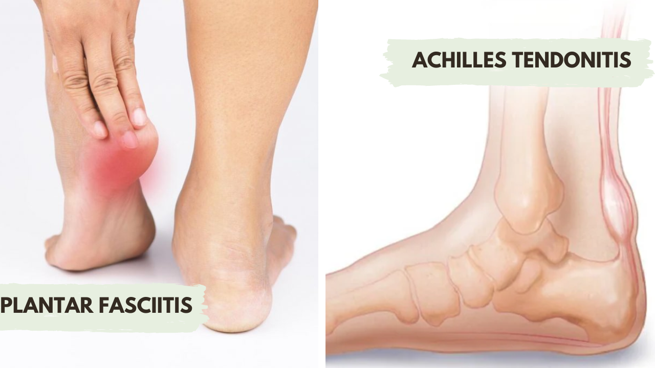 Read more about the article Achilles Tendonitis vs. Plantar Fasciitis: Which Do I Have?)