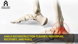 Read more about the article Ankle Reconstruction Surgery: Procedure, Recovery, and Risks