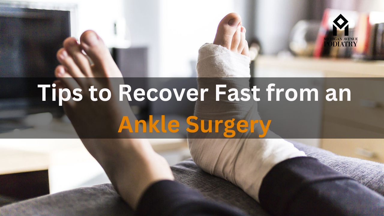 Read more about the article Tips to Recover Fast from an Ankle Surgery