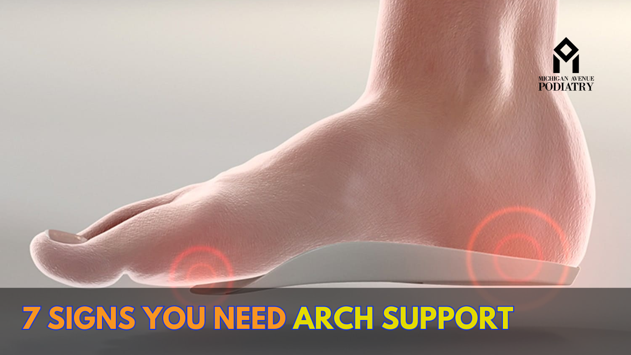 You are currently viewing 7 Signs You Need Arch Support