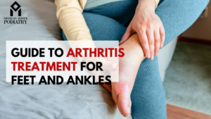 Read more about the article Guide to Arthritis Treatment for Feet and Ankles