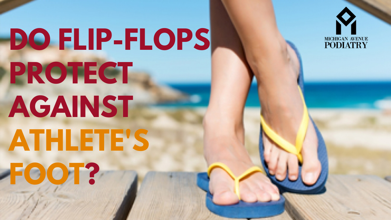 Read more about the article Do Flip-Flops Protect Against Athletes Foot?