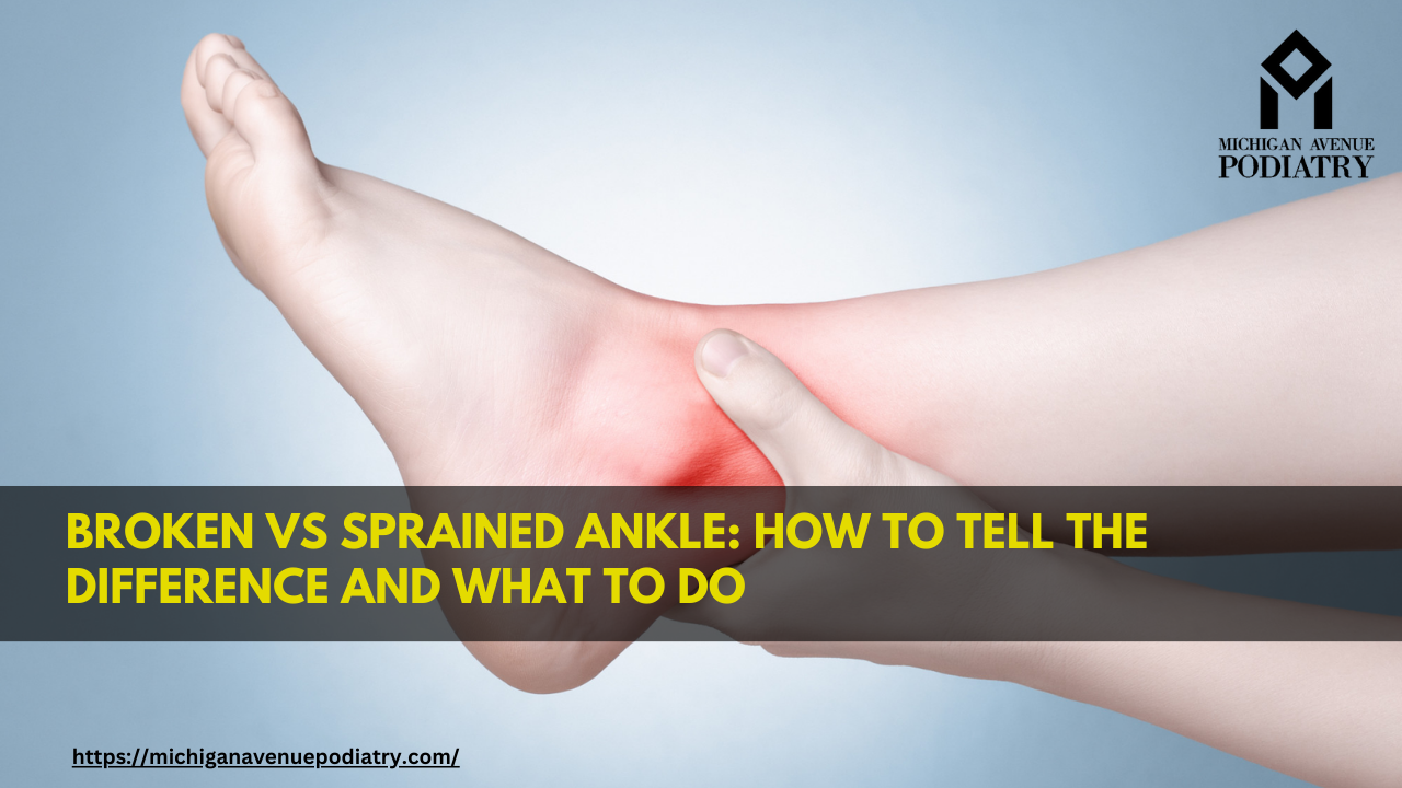 Read more about the article Broken Vs Sprained Ankle: How to Tell the Difference and What To Do