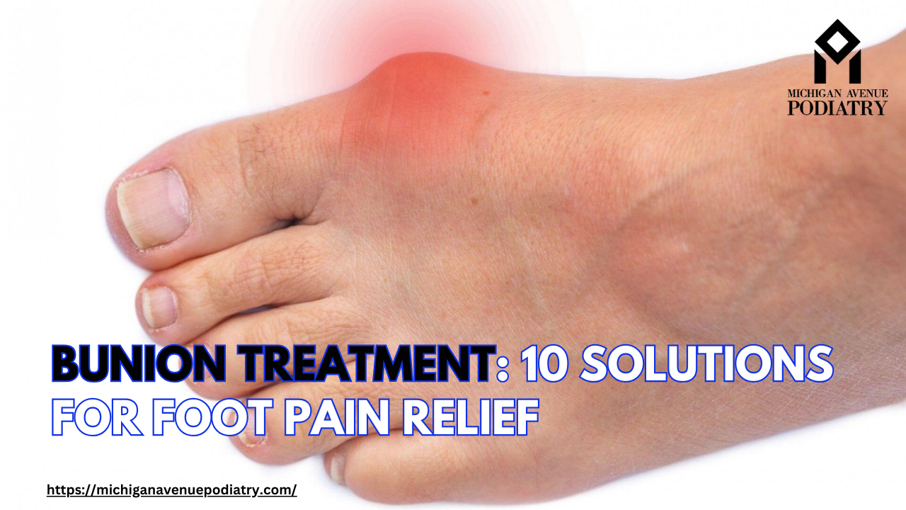 Read more about the article Bunion Treatment: 10 Solutions for Foot Pain Relief