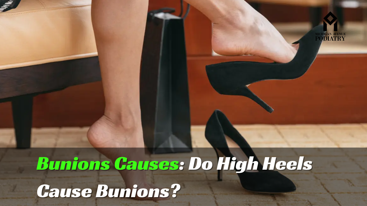 You are currently viewing Bunions Causes: Do High Heels Cause Bunions?