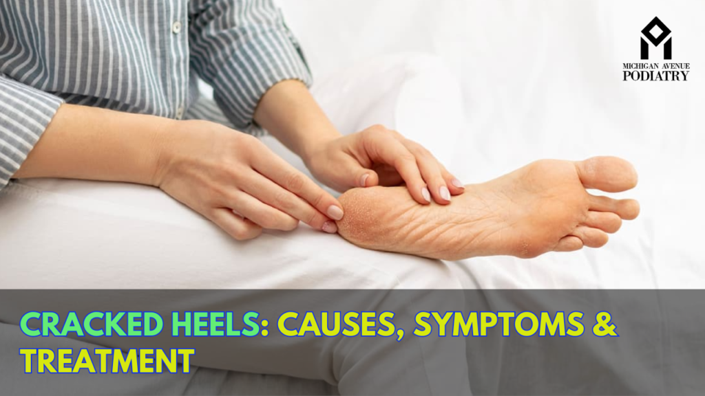 Cracked Heels: Causes, Symptoms & Treatment