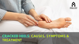 Read more about the article Cracked Heels: Causes, Symptoms & Treatment