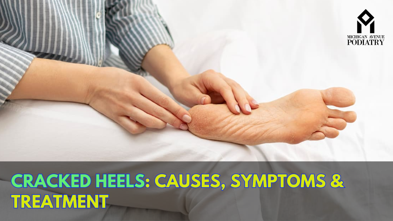You are currently viewing Cracked Heels: Causes, Symptoms & Treatment