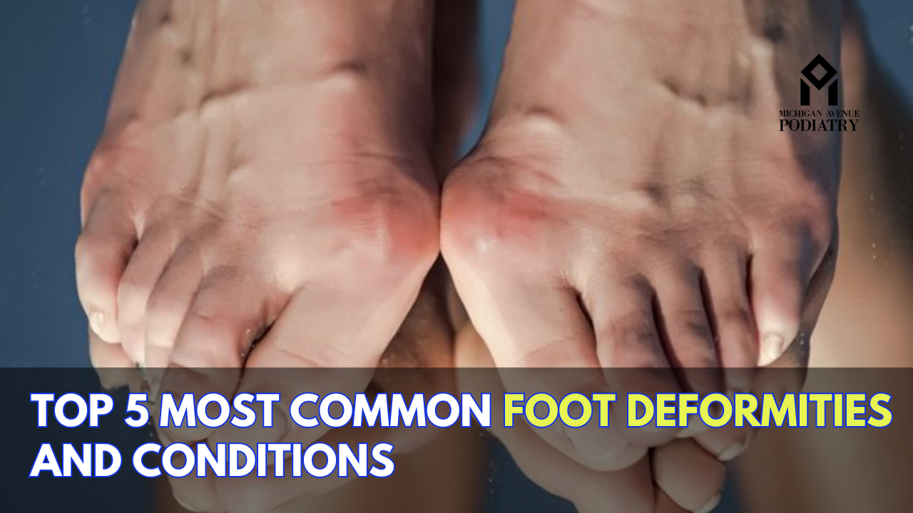 You are currently viewing Top 5 Most Common Foot Deformities and Conditions