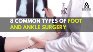 Read more about the article 8 Common Types of Foot and Ankle Surgery