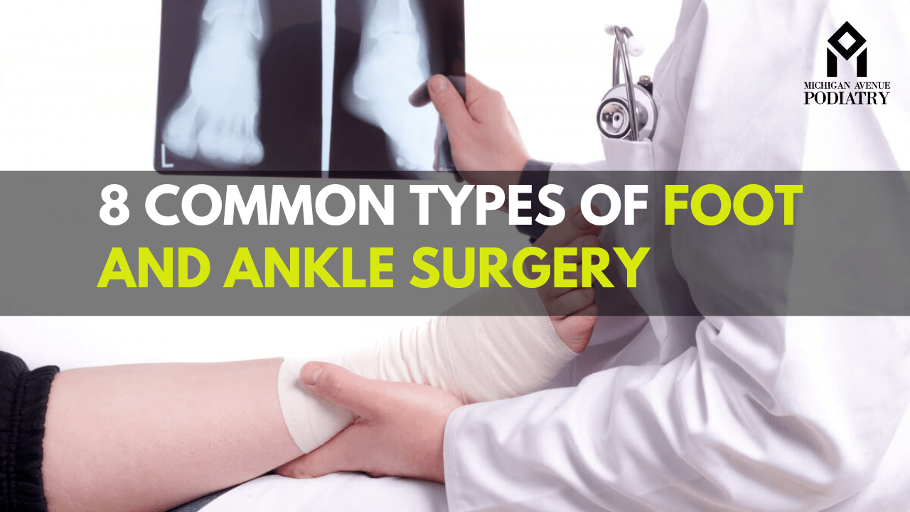 You are currently viewing 8 Common Types of Foot and Ankle Surgery