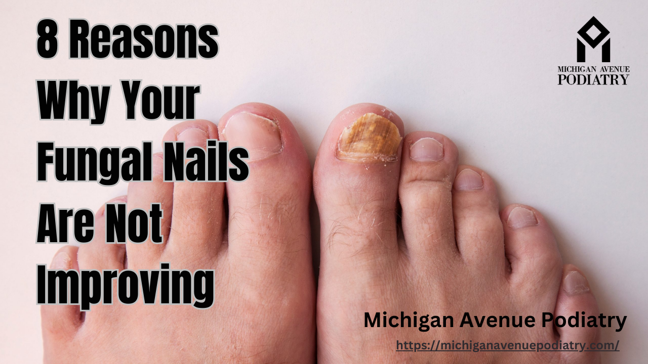 You are currently viewing 8 Reasons Why Your Fungal Nails Are Not Improving