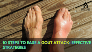 Read more about the article 10 Steps to Ease a Gout Attack: Effective Strategies