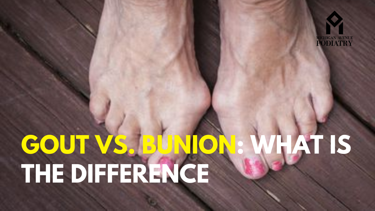 You are currently viewing Gout vs. Bunion: What is the Difference