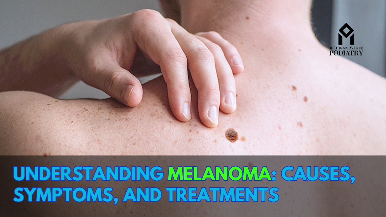 You are currently viewing Understanding Melanoma: Causes, Symptoms, and Treatments