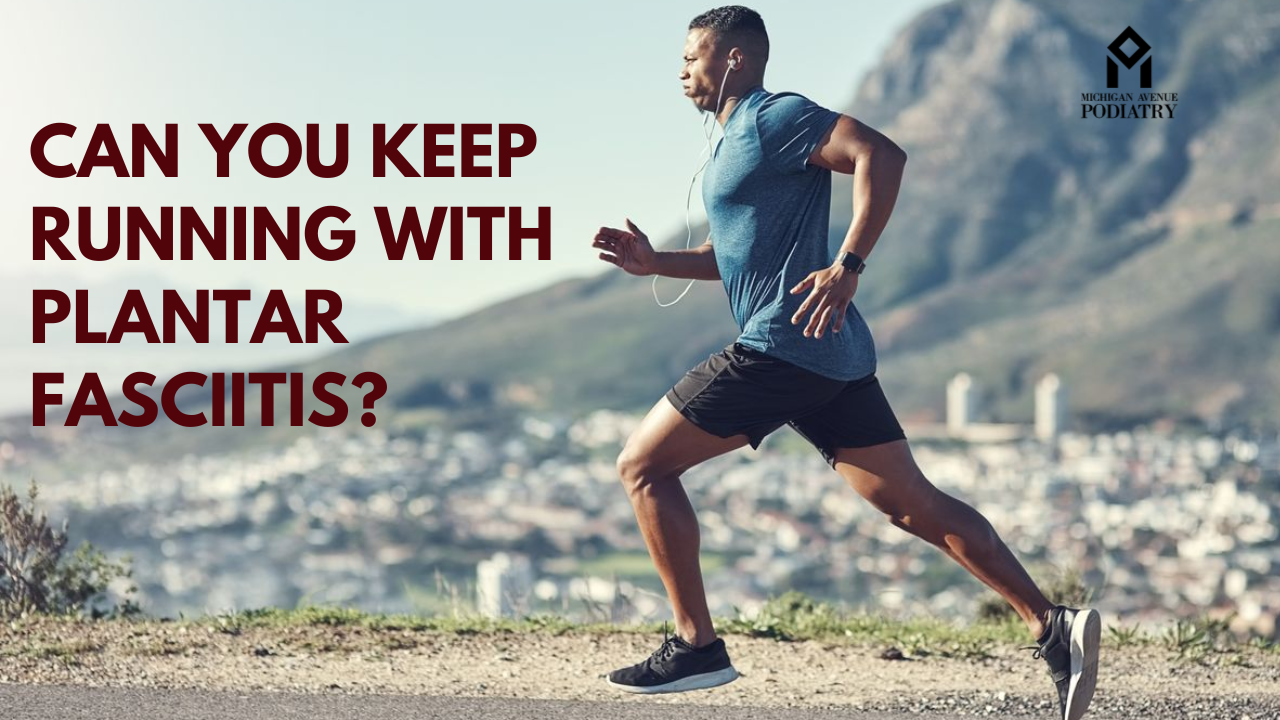 Read more about the article Can You Keep Running with Plantar Fasciitis?