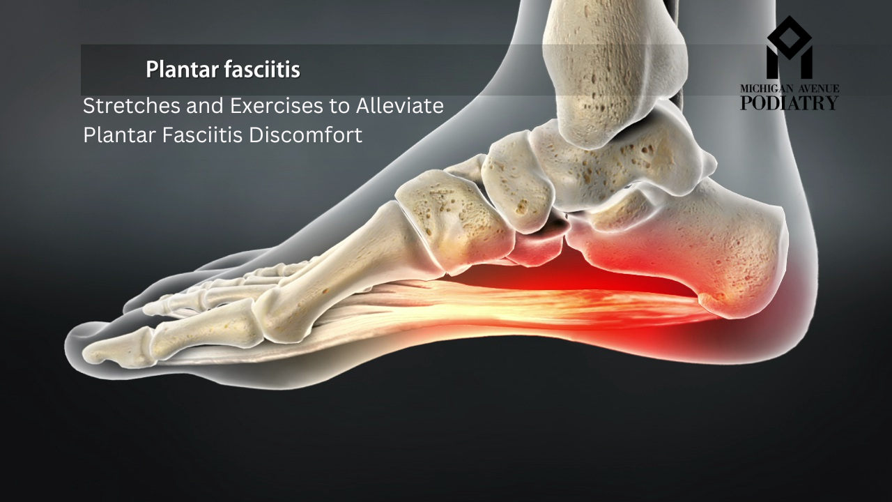 Read more about the article Stretches and Exercises to Alleviate Plantar Fasciitis Discomfort