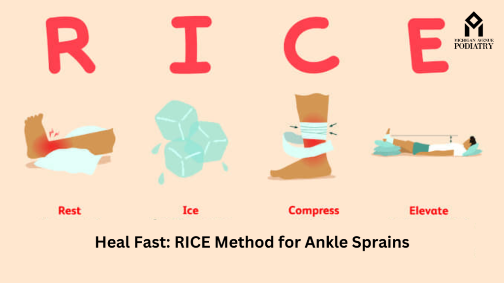 RICE Method for Ankle Sprains
