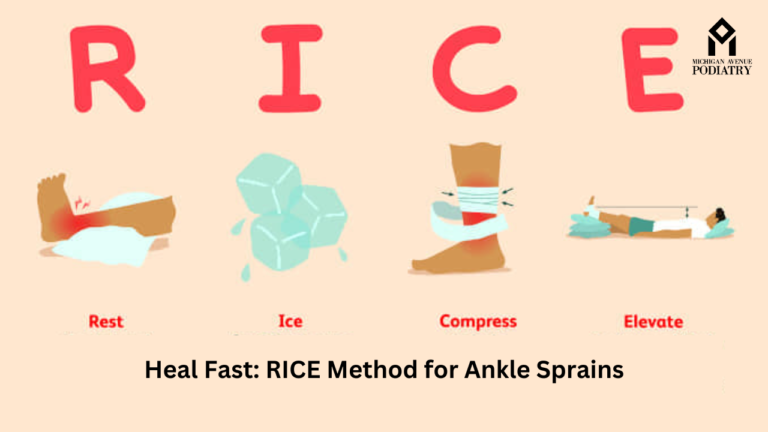 heal-fast-rice-method-for-ankle-sprains