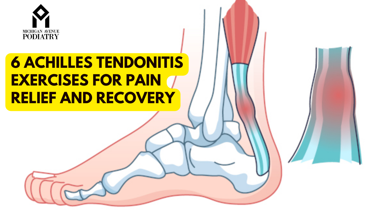 Read more about the article 6 Achilles Tendonitis Exercises for Pain Relief and Recovery