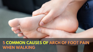 Read more about the article 5 Common Causes of Arch of Foot Pain when walking