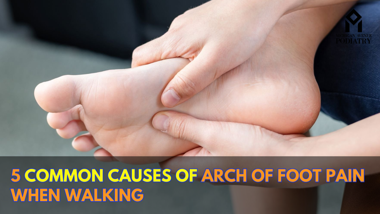 You are currently viewing 5 Common Causes of Arch of Foot Pain when walking