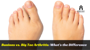 Bunions vs Big Toe Arthritis