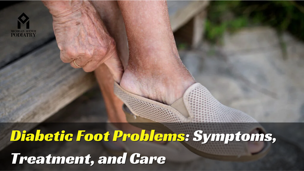 You are currently viewing Diabetic Foot Problems: Symptoms, Treatment, and Care