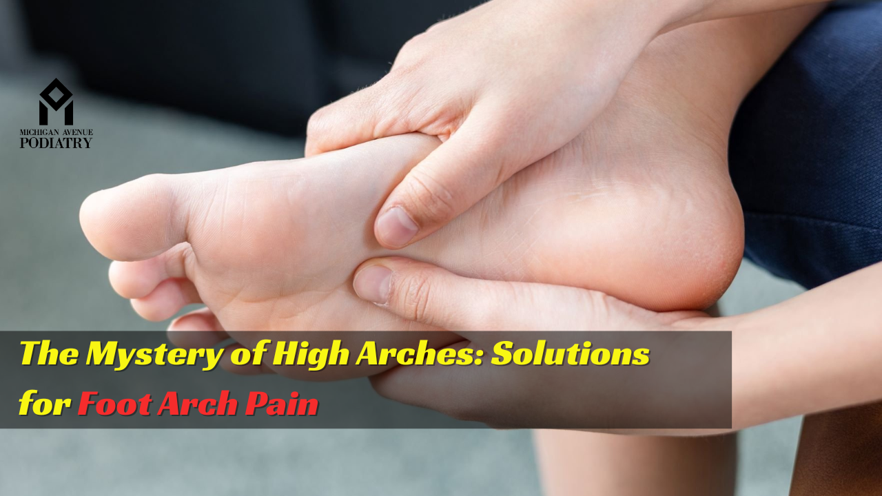 Read more about the article The Mystery of High Arches: Solutions for Foot Arch Pain