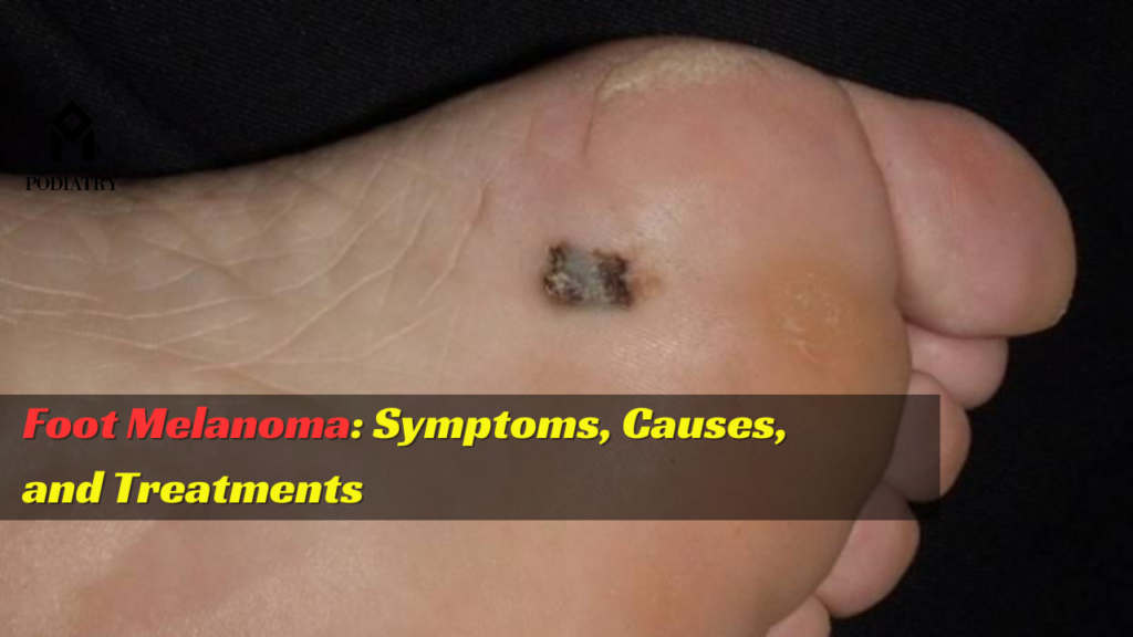Foot Melanoma Symptoms, Causes, And Treatments