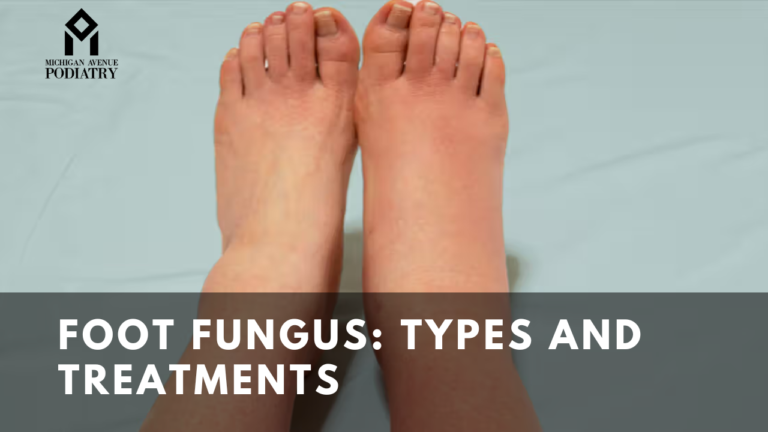 Foot Fungus: Types And Treatments