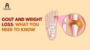 Gout and Weight Loss