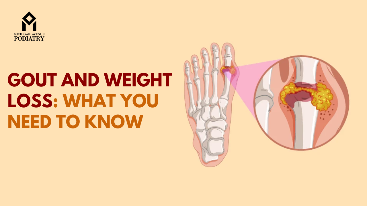 You are currently viewing Gout and Weight Loss: What You Need to Know