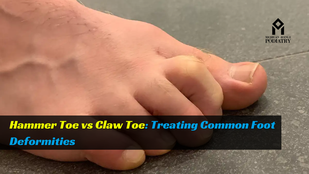 Read more about the article Hammer Toe vs. Claw Toe: Recognizing and Treating Common Foot Deformities