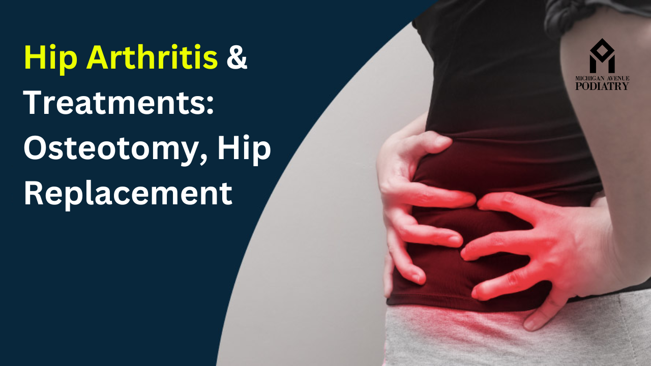 Read more about the article Hip Arthritis & Treatments: Osteotomy, Hip Replacement