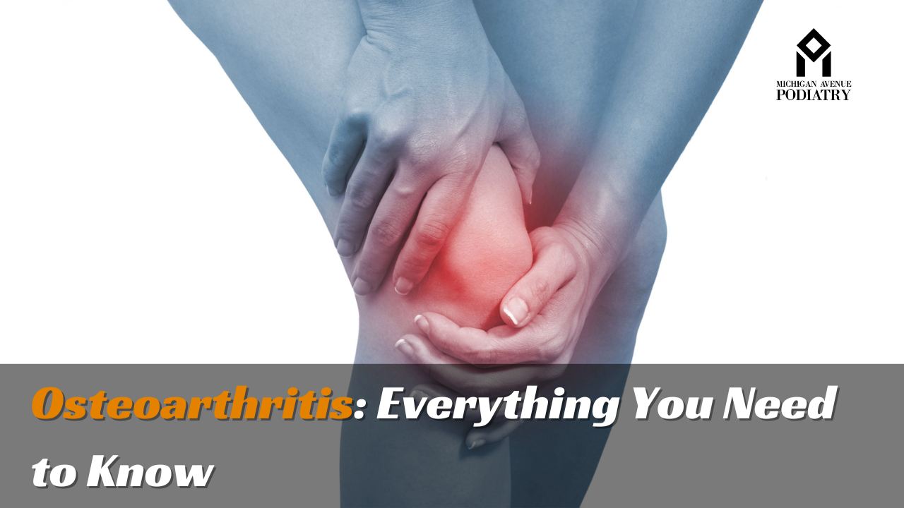 You are currently viewing Osteoarthritis: Everything You Need to Know