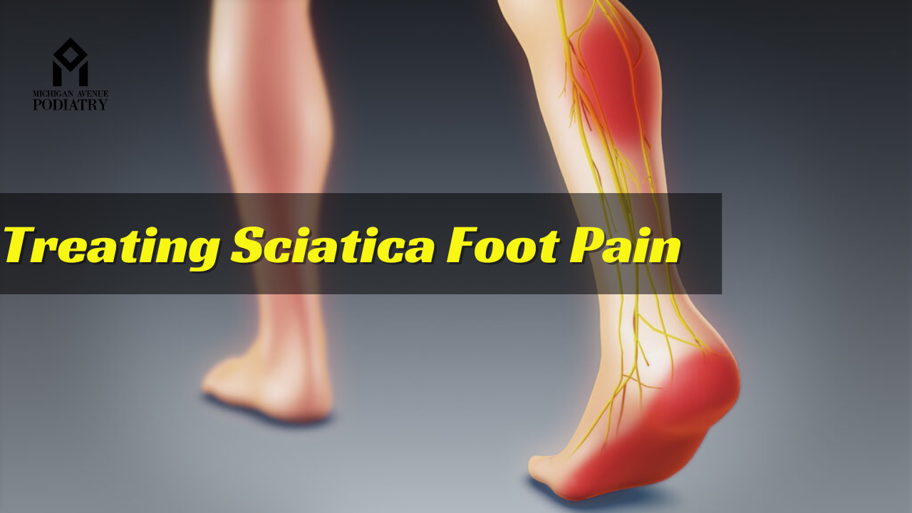 You are currently viewing Treating Sciatica Foot Pain | Best Podiatrist in Chicago, IL