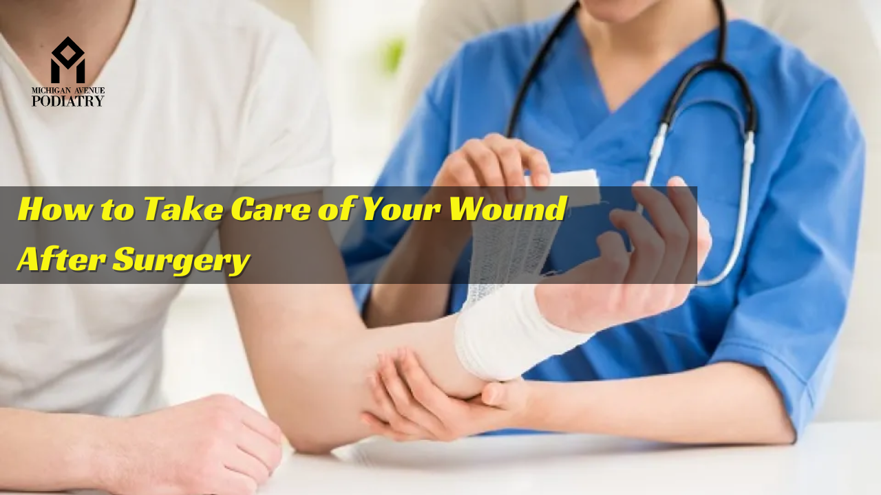 You are currently viewing How to Take Care of Your Wound After Surgery