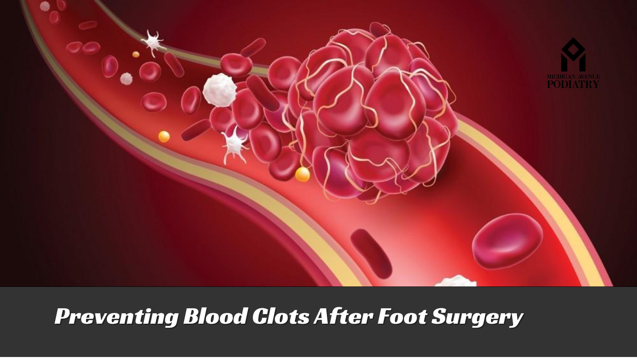 Read more about the article Preventing Blood Clots After Foot Surgery