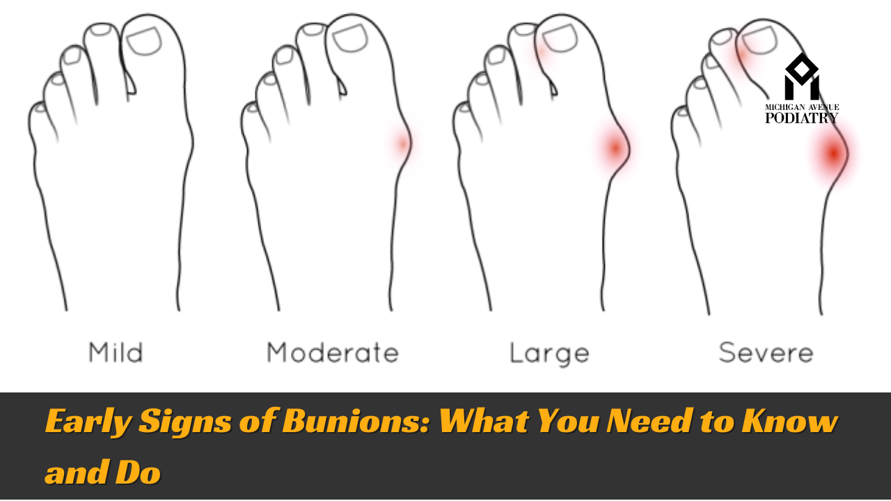 Read more about the article Early Signs of Bunions: What You Need to Know and Do
