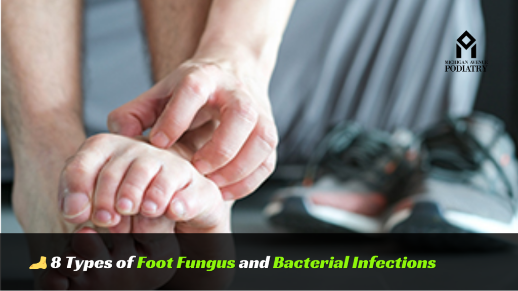 8 Types Of Foot Fungus And Bacterial Infections