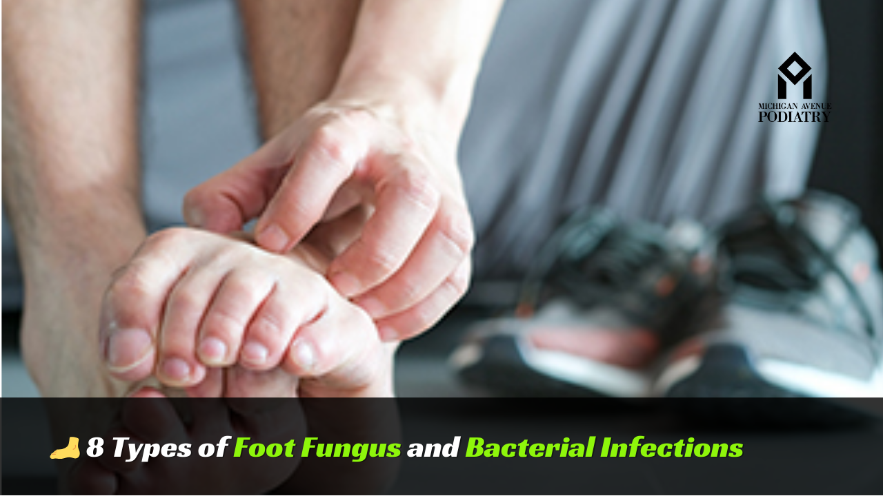 You are currently viewing 8 Types of Foot Fungus and Bacterial Infections