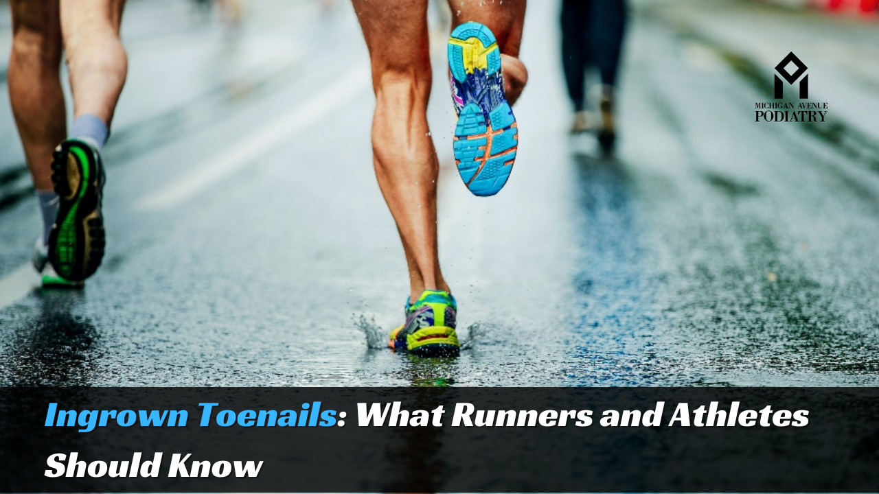 Read more about the article Ingrown Toenails: What Runners and Athletes Should Know