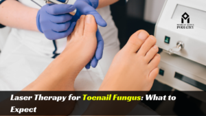 Read more about the article Laser Therapy for Toenail Fungus: What to Expect